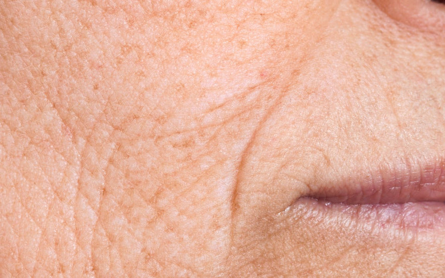 ¿Qué es la ritidosis y cómo combatirla de forma eficaz?