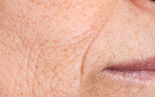 ¿Qué es la ritidosis y cómo combatirla de forma eficaz?